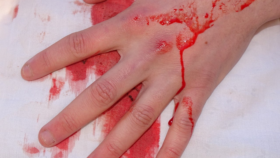 Près de Grenoble : un homme poignardé opéré en urgence Près de Grenoble : un homme poignardé opéré en urgence